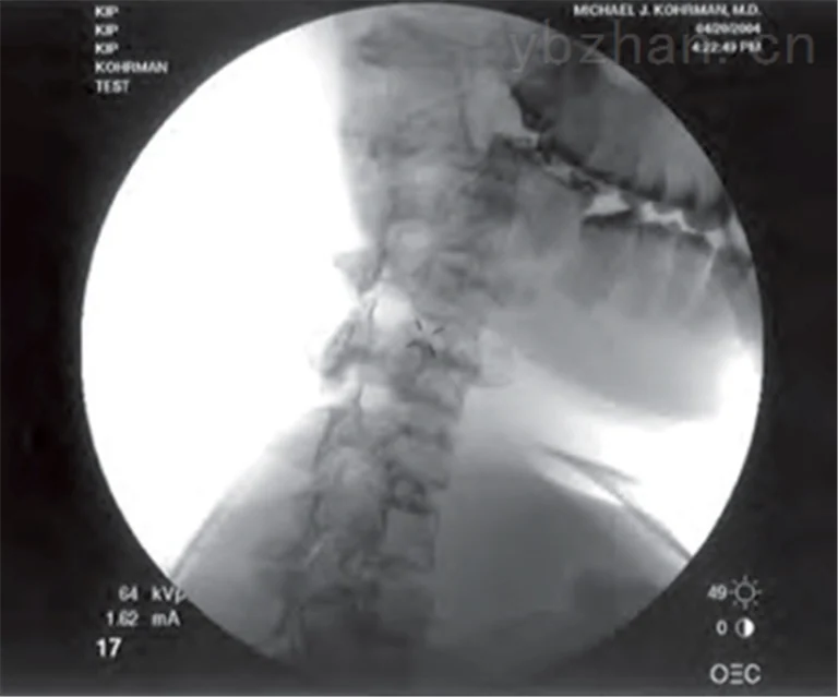 American RSD injection mold image 3