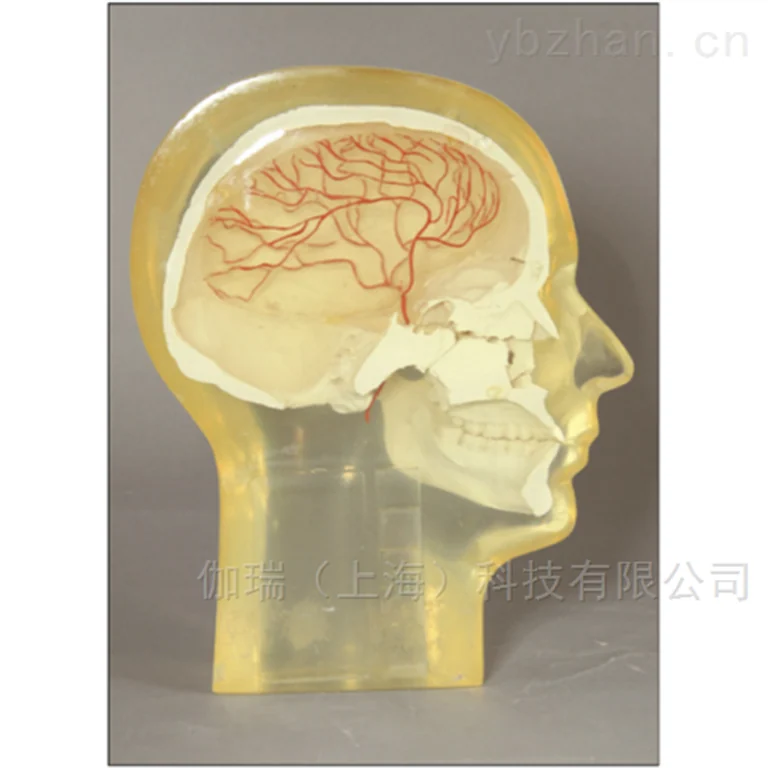 American RSD phantom angiography head phantom image 2