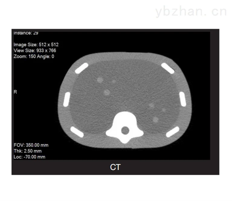 CIRS 071B图像引导腹部穿刺模体产品图片 3