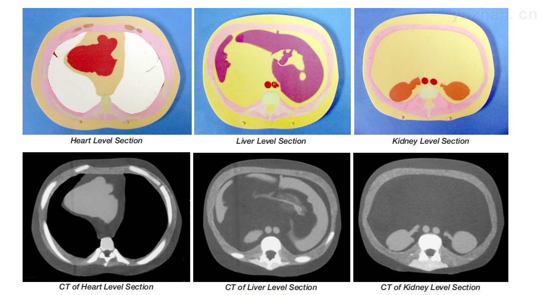 American CIRS 600 3D cross-section torso model phantom image